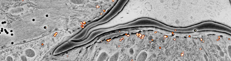 Clathrin-Pharynx. Clathrin light chain imaged by PALM correlated with apical surface of pharynx in C. elegans (Watanabe and Jorgensen)