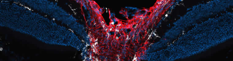Section of retina and optic nerve of mouse, microglia (white) and astrocytes (red)  (Bosco and Vetter).