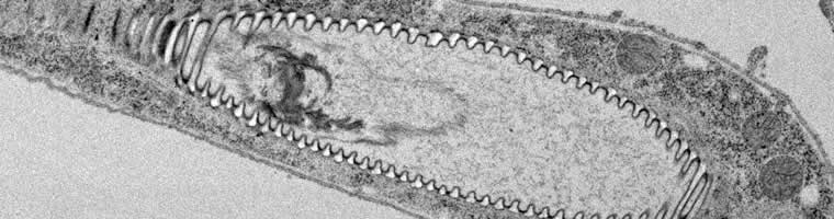 A unicellular tracheal branch forms as a lumen inside specialized cells (Niklova and Metzstein).