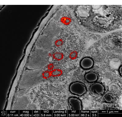 Introduction to Electron Microscopy - Advanced Microscopy - Imaging  Facilities - The University of Utah