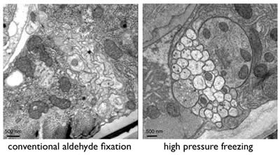 https://advanced-microscopy.utah.edu/_images/content/education/electron-micro/nerve-cord.jpg